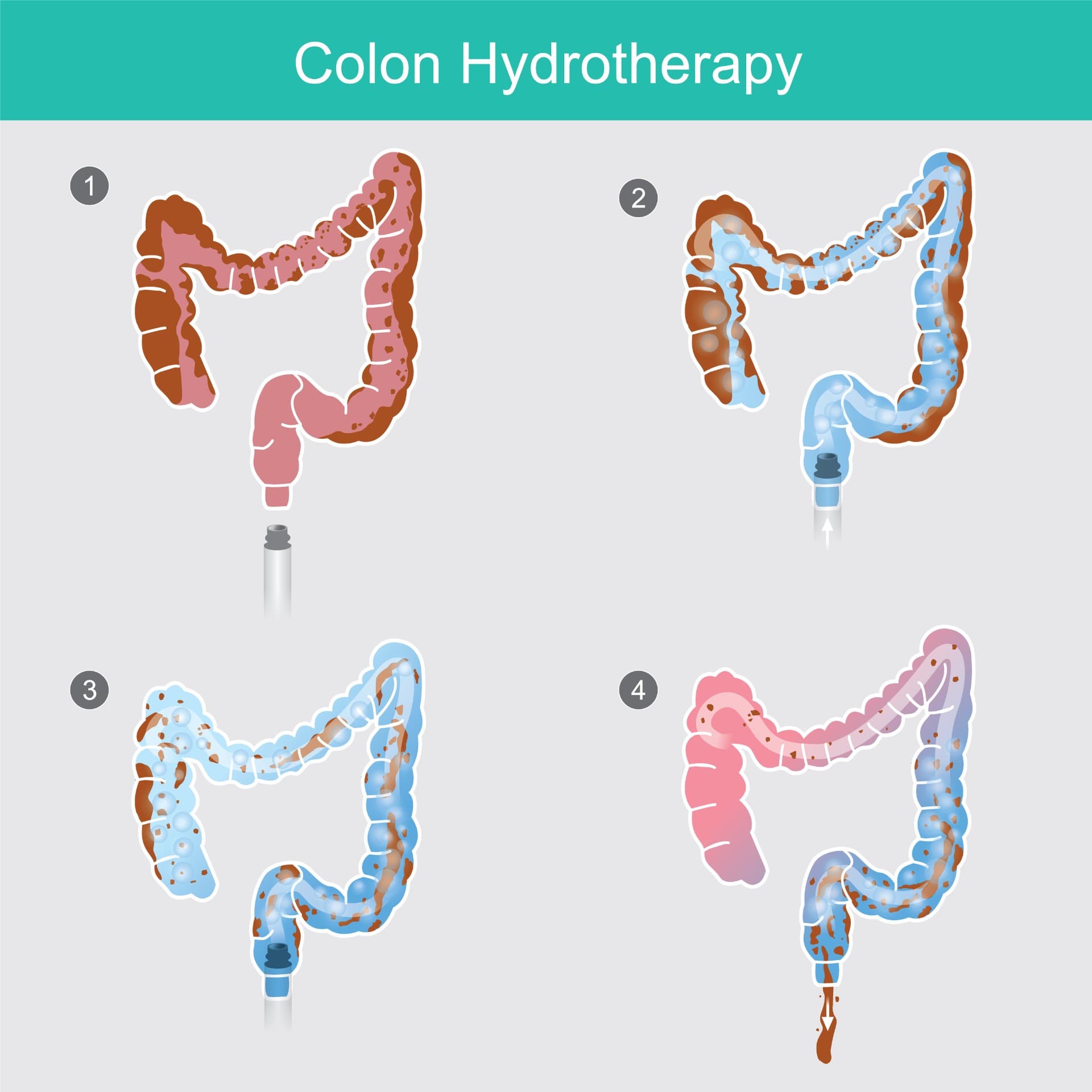 bigstock-Colon-Hydrotherapy-The-Secret-312036850.jpg