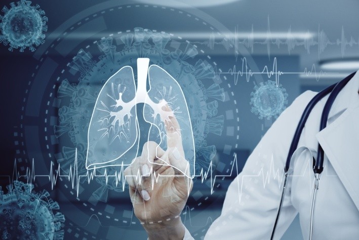 Low Dose CT Scan คือวิธีคัดกรอง ตรวจมะเร็งปอด ที่ได้รับความนิยม