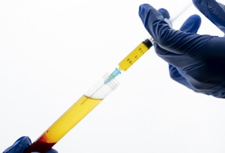 thumbnails-symptoms-prp.jpg