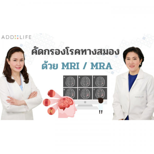 ข่าวสารความรู้ - การคัดกรองโรคทางสมองด้วย MRI/MRA